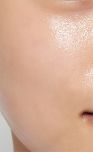 油性肌、混合肌、毛孔粗大