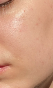 膚色暗沉、蠟黃